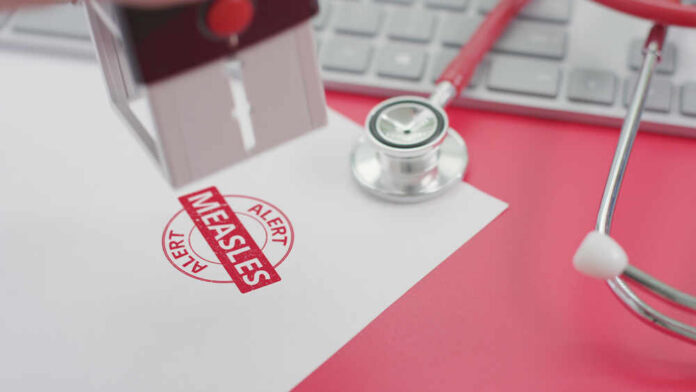 A stamp marking 'MEASLES ALERT' on a piece of paper next to a stethoscope and keyboard