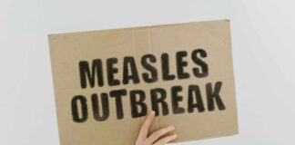 Measles outbreak sign