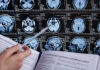 NFL Star Dead — Doctors Stunned Person analyzing brain MRI images with a pen.