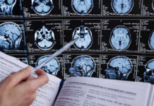 NFL Star Dead — Doctors Stunned Person analyzing brain MRI images with a pen.