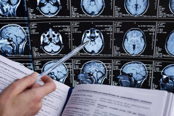 shutterstock_1147345778 Person analyzing brain MRI images with a pen.