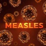 Deadly Measles Returns — Officials Stunned Illustration of measles virus particles with the word 'MEASLES' in bold
