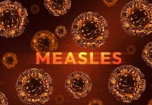 Deadly Measles Returns — Officials Stunned Illustration of measles virus particles with the word 'MEASLES' in bold