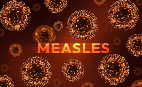 Measles,Disease,Outbreak,Concept,Design,With,Orange,And,Yellow,Virus Illustration of measles virus particles with the word 'MEASLES' in bold