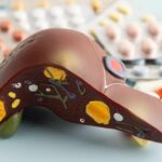 Liver Fat Torched — Doctors Shocked