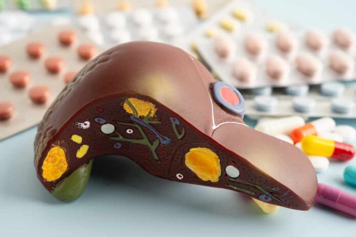 Liver,Model,With,Pill,Drug,Treatment,,Cirrhosis,,Liver,Cancer,,Fatty